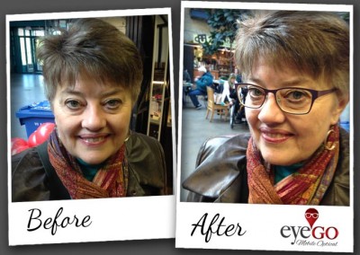 EyeGO Before & After