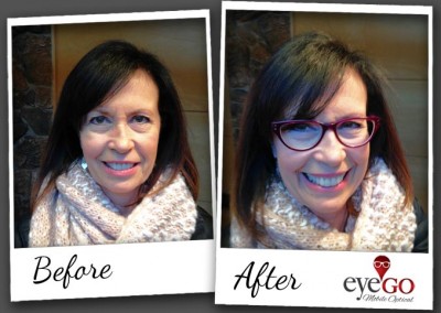 EyeGO Before & After